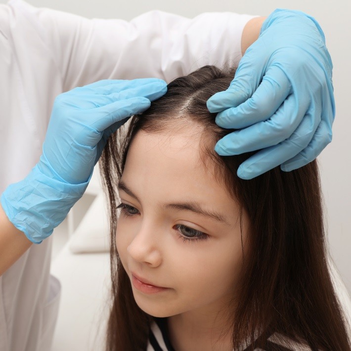 Alternative Lice Treatments