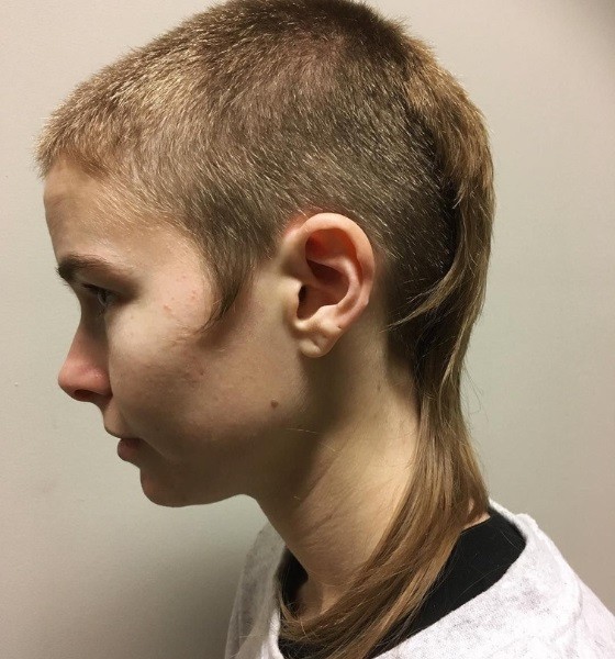 Bald Rat Tail Haircut