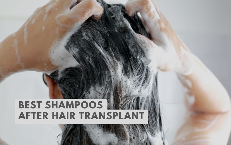 best shampoos after hair transplant